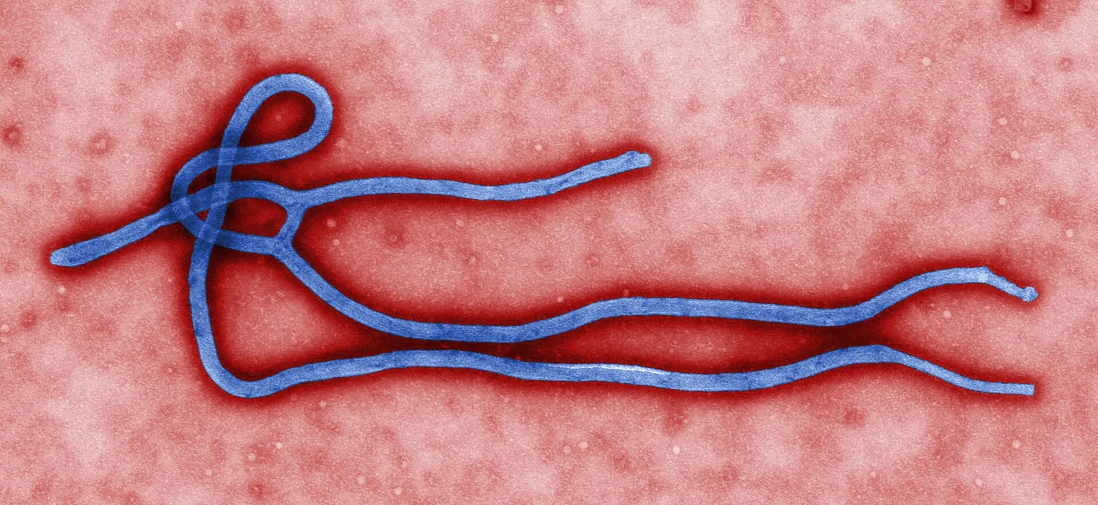 Elektronenmicroscopische opname van een ebolavirusdeeltje